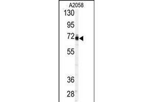 Western blot analysis of anti-P in A2058 cell line lysates (35ug/lane). (PAPSS1 抗体  (C-Term))