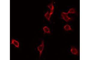 ABIN6276930 staining NIH-3T3 by IF/ICC. (GLB1 抗体  (Internal Region))