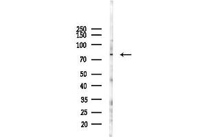 anti-Interleukin 17 Receptor D (IL17RD) (C-Term) antibody