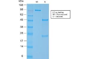 SDS-PAGE Analysis Purified SM-MHC Recombinant Rabbit Monoclonal Antibody (MYH11/2303R). (Recombinant MYH11 抗体)