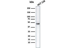 Western Blot analysis of HCT116 cell lysate using using Cytokeratin 8 Mouse Monoclonal Antibody (C-43). (KRT8 抗体)