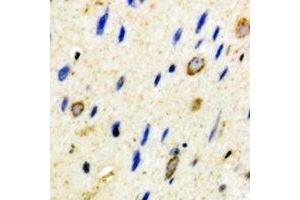 Immunohistochemical analysis of CD59 staining in mouse brain formalin fixed paraffin embedded tissue section. (CD59 抗体)