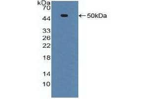 Western blot analysis of recombinant Human ADRbK1. (TNFRSF1A 抗体  (AA 60-236))