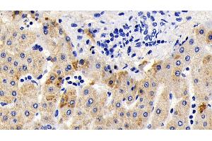 Detection of AIF in Human Liver Tissue using Polyclonal Antibody to Apoptosis Inducing Factor (AIF) (AIF 抗体  (AA 103-322))
