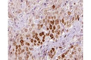 ABIN6266720 at 1/100 staining human liver tissue sections by IHC-P. (REV3L 抗体  (N-Term))