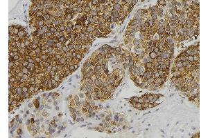 ABIN6277898 at 1/100 staining Human pancreas tissue by IHC-P. (Renin 抗体  (Internal Region))