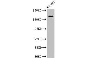 Western Blot Positive WB detected in: Rat kidney tissue All lanes: USP6 antibody at 4 μg/mL Secondary Goat polyclonal to rabbit IgG at 1/50000 dilution Predicted band size: 159, 122, 90 kDa Observed band size: 159 kDa