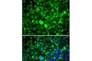 Immunofluorescence analysis of MCF7 cells using RPLP1 Polyclonal Antibody (RPLP1 抗体)