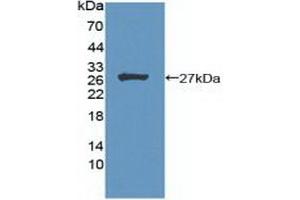 Detection of Recombinant MEN1, Human using Polyclonal Antibody to Menin (MEAI) (Menin 抗体  (AA 219-395))