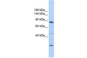 CDC5L antibody used at 1 ug/ml to detect target protein. (CDC5L 抗体)