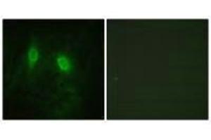 Immunofluorescence analysis of HeLa cells, using IKK-γ (Ab-85) antibody.