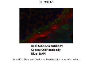 Primary Antibody Dilution :  1:200  Secondary Antibody :   Goat anti-rabbit Alexafluor 568  Secondary Antibody Dilution :  1:200  Color/Signal Descriptions :  SLC38A3: Red CtBp: Green DAPI: Blue  Gene Name :  SLC38A3  Submitted by :  Anonymous (SLC38A3 抗体  (N-Term))