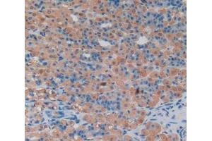 IHC-P analysis of stomach tissue, with DAB staining. (LCN8 抗体  (AA 25-176))