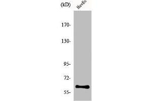 Western Blot analysis of COLO205 cells using hnRNP LL Polyclonal Antibody