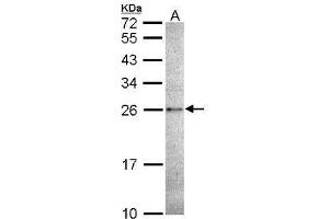WB Image Sample (30 ug of whole cell lysate) A: A431 , 12% SDS PAGE antibody diluted at 1:1000 (CASP14 抗体  (C-Term))