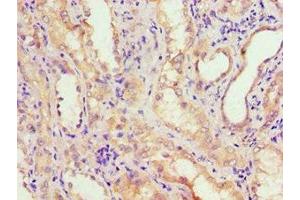 Immunohistochemistry of paraffin-embedded human kidney tissue using ABIN7143650 at dilution of 1:100 (ADH4 抗体  (AA 1-380))