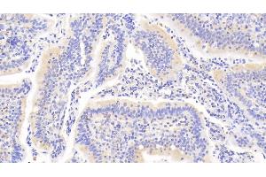 Immunohistochemistry (IHC) image for anti-Tyrosine-Protein Phosphatase Non-Receptor Type 22 (PTPN22) (AA 1-233) antibody (ABIN7444976)