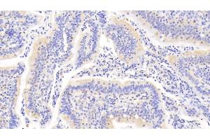 Detection of PTPN22 in Human Small intestine Tissue using Polyclonal Antibody to Protein Tyrosine Phosphatase, Non Receptor Type 22 (PTPN22) (PTPN22 抗体  (AA 1-233))