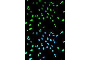Immunofluorescence analysis of HeLa cells using TARDBP antibody. (TARDBP 抗体)