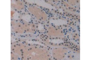 Used in DAB staining on fromalin fixed paraffin- embedded Kidney tissue (IRF2 抗体  (AA 1-349))