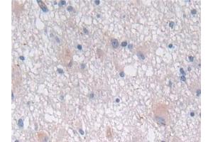 Immunohistochemistry (IHC) image for anti-Sema Domain, Immunoglobulin Domain (Ig), Short Basic Domain, Secreted, (Semaphorin) 3E (SEMA3E) (AA 32-516) antibody (ABIN7430111)
