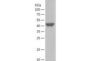 Western Blotting (WB) image for Myosin Heavy Chain 1, Skeletal Muscle, Adult (MYH1) (AA 449-651) protein (His-IF2DI Tag) (ABIN7283123) (MYH1 Protein (AA 449-651) (His-IF2DI Tag))