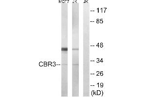 Immunohistochemistry analysis of paraffin-embedded human colon carcinoma tissue, using CBR3 antibody. (CBR3 抗体)