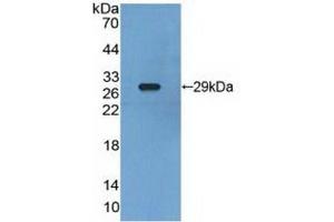 Detection of Recombinant RXRg, Human using Polyclonal Antibody to Retinoid X Receptor Gamma (RXRg) (Retinoid X Receptor gamma 抗体  (AA 12-220))