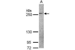 WB Image Sample (30 ug of whole cell lysate) A: IMR32 5% SDS PAGE antibody diluted at 1:500 (THADA 抗体  (C-Term))