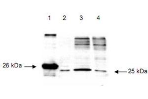 Immunoblot using DIABLO polyclonal antibody  detects a 26 kDa band when 1 ug of recombinant DIABLO is applied (lane 1). (DIABLO 抗体  (AA 56-239))
