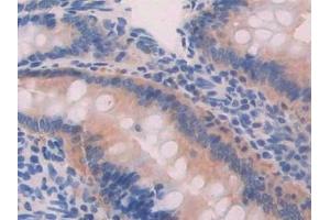 Immunohistochemistry (IHC) image for anti-phosphofructokinase, Platelet (PFKP) (AA 354-570) antibody (ABIN7443782)
