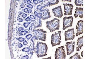 Immunohistochemistry (IHC) image for anti-Cytochrome P450, Family 2, Subfamily D, Polypeptide 6 (CYP2D6) (AA 315-347), (C-Term) antibody (ABIN5518823)