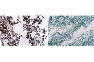 MyoD Immunohistochemistry. (MYOD1 抗体  (Internal Region))