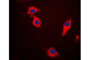 Immunofluorescent analysis of Beta-synuclein staining in HeLa cells. (beta Synuclein 抗体  (C-Term))