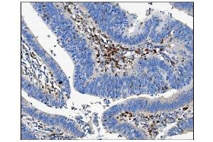 IHC analysis of CD16 using anti-CD16 antibody (ABIN5693196).