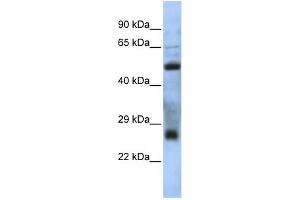 WB Suggested Anti-MGC26647 Antibody Titration: 0. (MGC26647 (N-Term) 抗体)