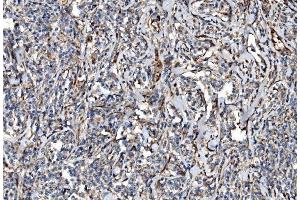 IHC analysis of NLRP7 using anti-NLRP7 antibody (ABIN7599027).