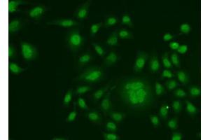 Immunofluorescence analysis of HeLa cells using ERCC1 antibody. (ERCC1 抗体  (AA 1-323))