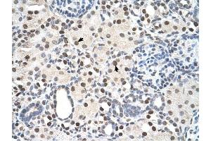 PSME3 antibody was used for immunohistochemistry at a concentration of 4-8 ug/ml to stain Epithelial cells of renal tubule (arrows) in Human Kidney. (PSME3 抗体  (N-Term))
