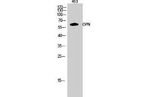 Western Blot (WB) analysis of 453 cells using OPN Polyclonal Antibody. (Osteopontin 抗体  (C-Term))