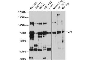 Western blot analysis of extracts of various cell lines, using ZP1 antibody (ABIN6130973, ABIN6150532, ABIN6150533 and ABIN6214972) at 1:1000 dilution. (ZP1 抗体  (AA 340-610))