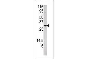 Image no. 1 for anti-Dual Specificity Phosphatase 3 (DUSP3) (N-Term) antibody (ABIN360840) (Dual Specificity Phosphatase 3 (DUSP3) (N-Term) 抗体)