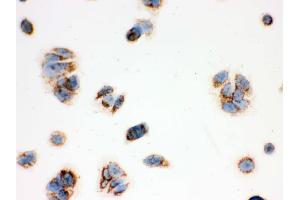 IHC analysis of ERAB using anti-ERAB antibody . (HSD17B10 抗体  (AA 48-261))