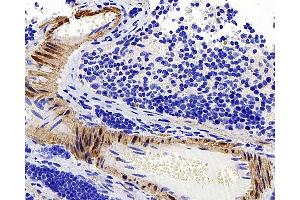 Immunohistochemistry (Paraffin-embedded Sections) (IHC (p)) image for anti-Transgelin (TAGLN) antibody (ABIN7249760)