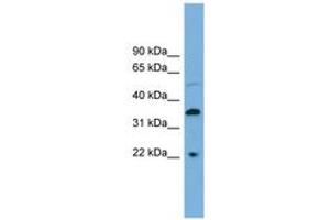 Image no. 1 for anti-Docking Protein 6 (DOK6) (C-Term) antibody (ABIN6745096) (DOK6 抗体  (C-Term))