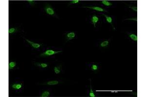 Immunofluorescence of monoclonal antibody to HES2 on HeLa cell. (HES2 抗体  (AA 41-114))