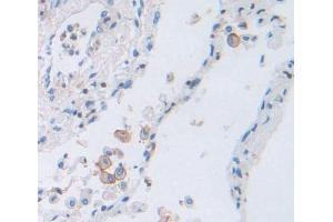 Used in DAB staining on fromalin fixed paraffin- embedded Kidney tissue (PCDH20 抗体  (AA 64-209))