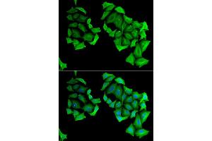 Immunofluorescence analysis of HeLa cell using C4BPB antibody. (C4BPB 抗体)