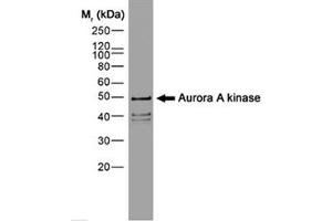 Image no. 1 for anti-Aurora Kinase A (AURKA) (N-Term) antibody (ABIN206445) (Aurora A 抗体  (N-Term))