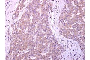 Immunohistochemistry (IHC) image for anti-Cytochrome P450, Family 7, Subfamily B, Polypeptide 1 (CYP7B1) (C-Term) antibody (ABIN2855947)